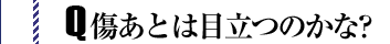 傷あとは目立ちますか?